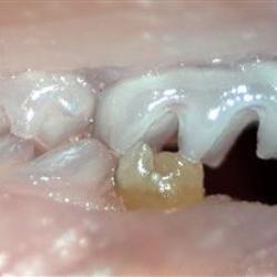 Эксперты вырастили зуб из стволовых клеток