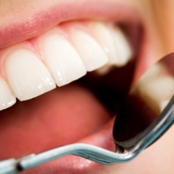Потеря зубов может привести к потере памяти