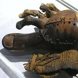 Самые первые протезы появились в Древнем Египте
