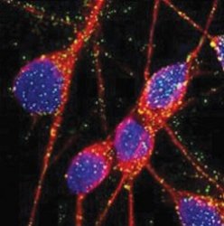 Из клеток кожи ученые создали клетки мозга  