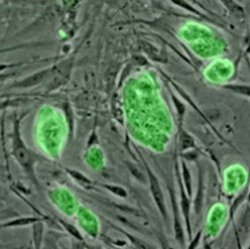 "Молодое" окружение возвращает к жизни старые стволовые клетки