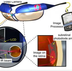Имплантаты для глаз на базе лазеров  восстановят зрение
