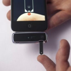 iPhone поможет диабетикам контролировать уровень глюкозы в крови
