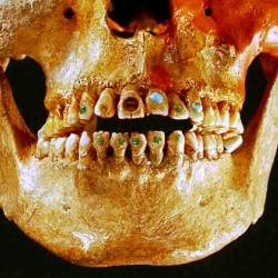 Мастерство стоматологов античности