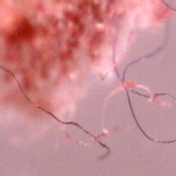 Моргеллонова болезнь: "бредовые паразиты" или новая трансгенная чума?  