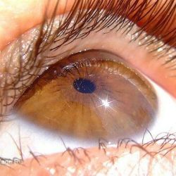Наши глаза – это "шрамы эволюции"?  