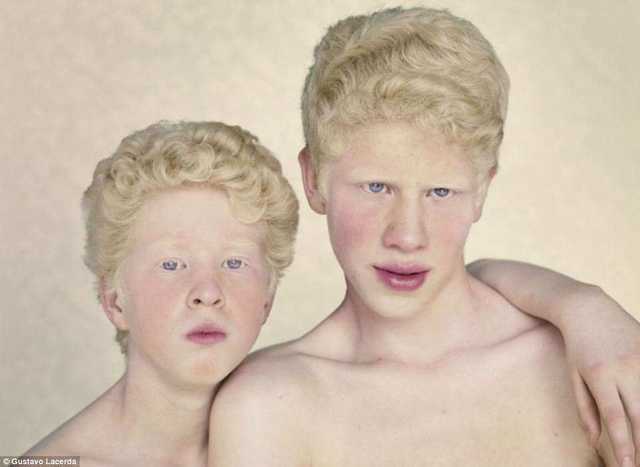 albinizm-4 - копия.jpg