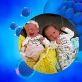 На свет появились близнецы из эмбрионов, замороженных 30 лет назад