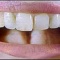 Найден ген, ответственный за рост зубов