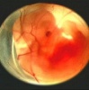Ошибочка вышла… Имплантация эмбриона не той женщине!