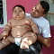 Самые большие дети в мире: 8-месячный ребенок весом 20 кг и другие